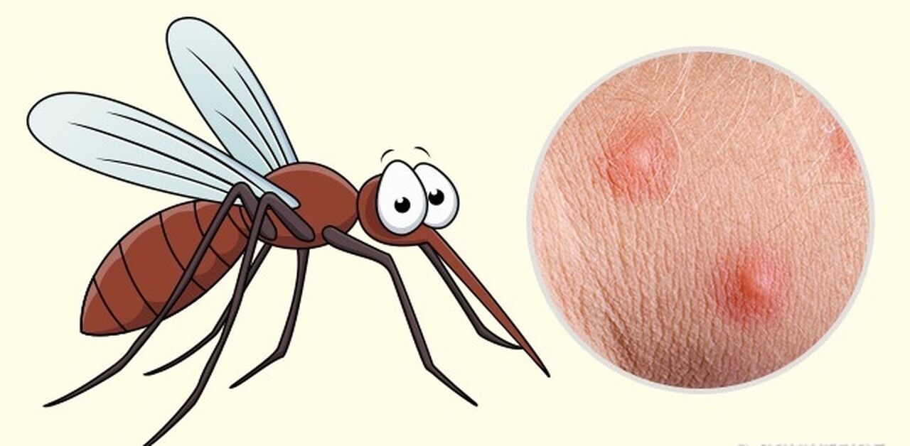 Vết đốt của muỗi sốt xuất huyết, muỗi sốt xuất huyết đốt có ngứa không? |  Omi Pharma
